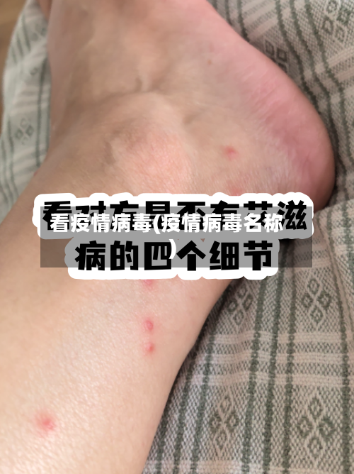 看疫情病毒(疫情病毒名称)