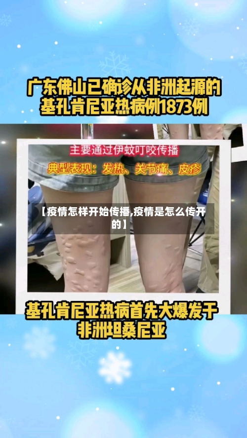 【疫情怎样开始传播,疫情是怎么传开的】